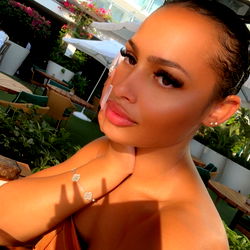 Pragtige Vrou in 'n Strokenkleid - OnlyFans Model Erica 💗