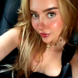 Pragtige Model met Vlooiende Oogskade – OnlyFans